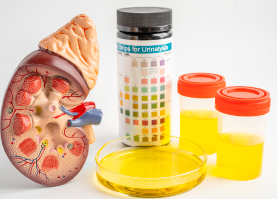 Testing for Kidney treatment