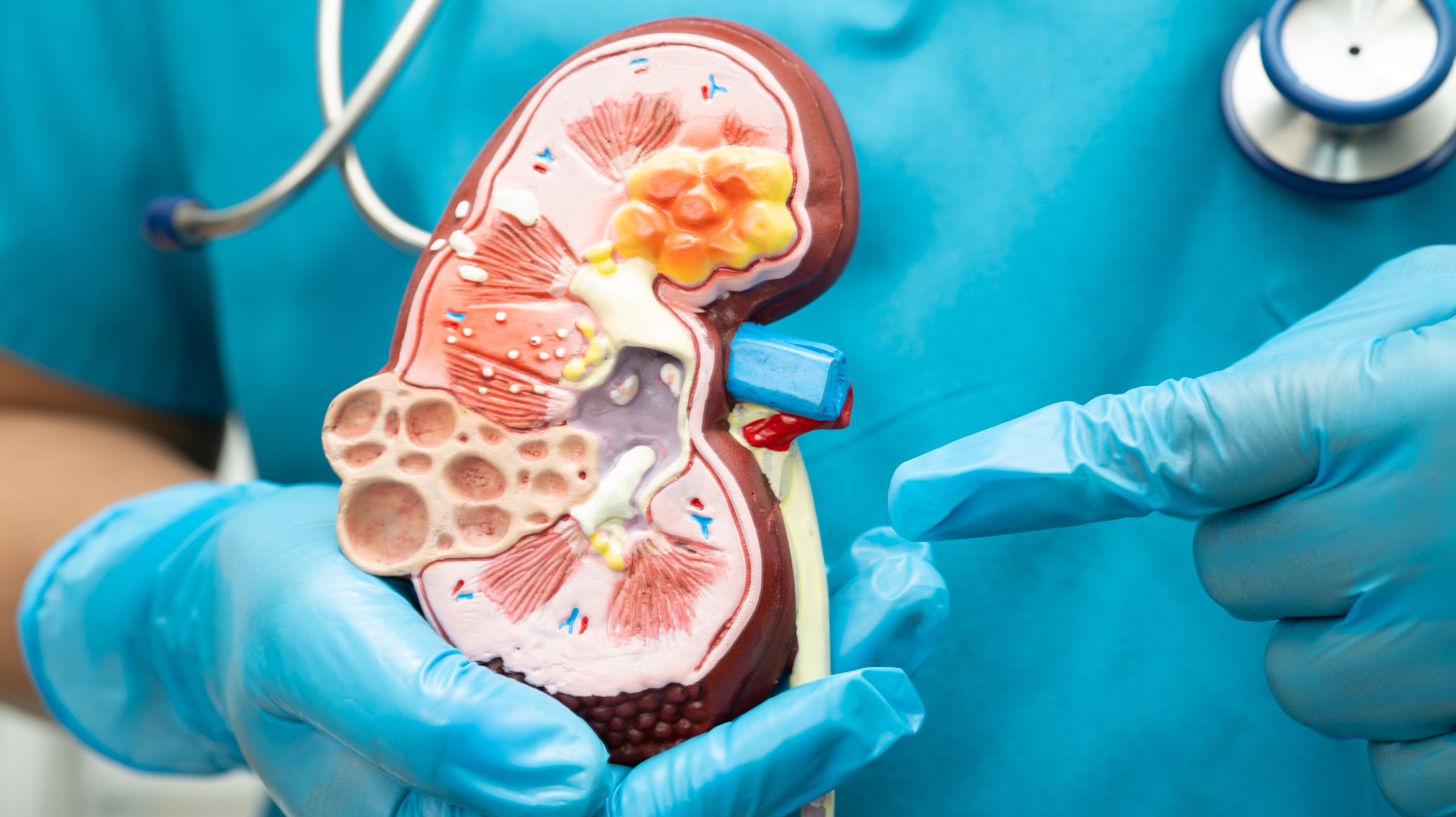 Nephrologist